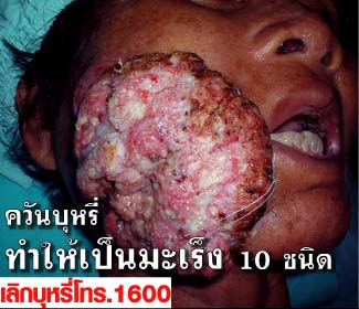 Thailand 2009 Health Effects mouth - diseased organ, gross